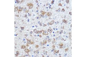 Immunohistochemistry of paraffin-embedded mouse brain using EL Rabbit pAb (ABIN7266914) at dilution of 100 (40x lens). (ELAVL4 anticorps  (AA 1-366))