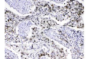 IHC analysis of MED18 using anti-MED18 antibody . (MED18 anticorps  (AA 1-208))