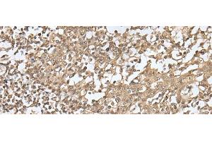 anti-Zinc Finger with KRAB and SCAN Domains 1 (ZKSCAN1) antibody