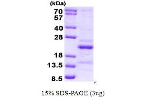 Image no. 1 for Steroid Receptor RNA Activator 1 (SRA1) (AA 90-236) protein (His tag) (ABIN6387071)