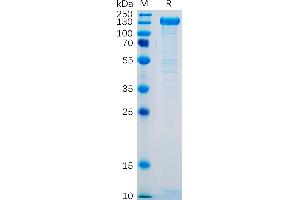 Human SELP Protein, hFc Tag on SDS-PAGE under reducing condition.