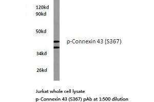 Western blot (WB) analyzes of p-Connexin 43 antibody in extracts from Jurkat cells. (Connexin 43/GJA1 anticorps  (pSer367))