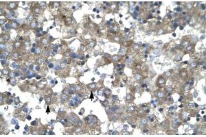Immunohistochemical staining (Formalin-fixed paraffin-embedded sections) of human liver with KLF15 polyclonal antibody . (KLF15 anticorps  (AA 45-94))