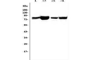 Western blot analysis of PRKCD using anti-PRKCD antibody (ABIN7601631).