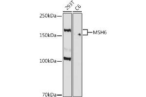 Western blot analysis of extracts of various cell lines, using MSH6 antibody (ABIN7268709) at 1:1000 dilution. (MSH6 anticorps)