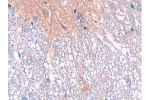 Detection of CD10 in Rat Spinal cord Tissue using Polyclonal Antibody to Neprilysin (CD10)