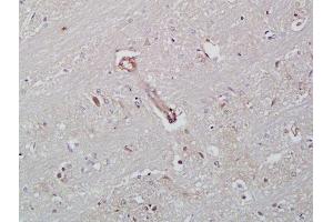 Formalin-fixed and paraffin embedded rat brain labeled with Rabbit Anti-ICAM-2/CD102 Polyclonal Antibody, Unconjugated  at 1:200 followed by conjugation to the secondary antibody and DAB staining (ICAM2 anticorps  (AA 175-277))