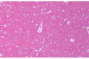 Anti-NRG1 antibody IHC staining of human brain, cortex. (Neuregulin 1 anticorps)