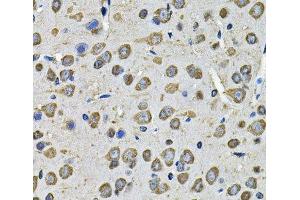 Immunohistochemistry of paraffin-embedded Rat brain using PDIA6 Polyclonal Antibody at dilution of 1:100 (40x lens). (PDIA6 anticorps)