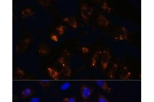 Immunofluorescence analysis of U2OS cells using TGFB1 Polyclonal Antibody at dilution of 1:100. (TGFB1 anticorps)