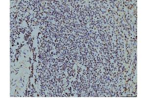IHC analysis of LSM8 using anti-LSM8 antibody (ABIN7599578). (NAA38 anticorps  (AA 1-96))