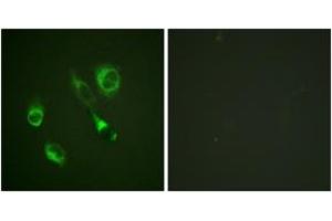 Immunofluorescence analysis of HeLa cells, using EPHA2/3 (Phospho-Tyr588/596) Antibody. (EPHA2/3 anticorps  (pTyr588))