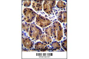 PKP2 Antibody immunohistochemistry analysis in formalin fixed and paraffin embedded human stomach tissue followed by peroxidase conjugation of the secondary antibody and DAB staining. (Plakophilin 2 anticorps  (C-Term))