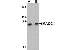 Western Blotting (WB) image for anti-Metastasis Associated in Colon Cancer 1 (MACC1) (Middle Region) antibody (ABIN1030992)