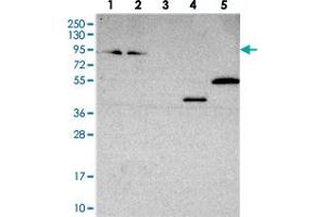 Western blot analysis of Lane 1: RT-4, Lane 2: U-251 MG, Lane 3: Human Plasma, Lane 4: Liver, Lane 5: Tonsil with ZNF235 polyclonal antibody  at 1:250-1:500 dilution. (ZNF235 anticorps)
