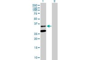 Western Blot analysis of ASPA expression in transfected 293T cell line by ASPA MaxPab polyclonal antibody. (ASPA anticorps  (AA 1-313))