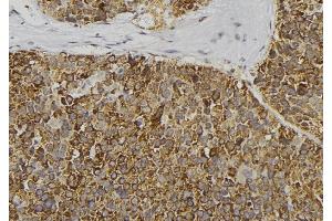 anti-Carboxypeptidase B1 (Tissue) (CPB1) (C-Term) antibody