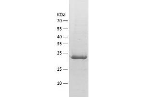 Western Blotting (WB) image for Ubiquitin Specific Peptidase 3 (USP3) (AA 313-520) protein (His tag) (ABIN7125593) (USP3 Protein (AA 313-520) (His tag))