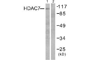 Western blot analysis of extracts from HuvEc cells, using HDAC7 antibody (#C0227). (HDAC7 anticorps)