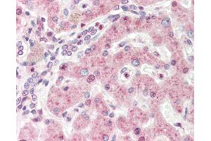 Human, Liver: Formalin-Fixed Paraffin-Embedded (FFPE).