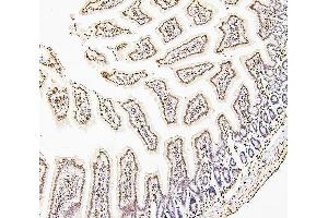 IHC analysis of H1F0 using anti-H1F0 antibody (ABIN7600521). (Histone H1 anticorps  (AA 20-159))