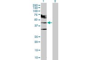 Western Blot analysis of TARDBP expression in transfected 293T cell line by TARDBP MaxPab polyclonal antibody. (TARDBP anticorps  (AA 1-414))