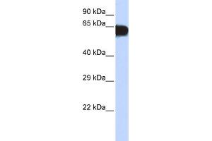 WB Suggested Anti-TBX18 Antibody Titration: 0. (T-Box 18 anticorps  (Middle Region))