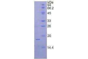 SDS-PAGE analysis of Human Ribonuclease A7 Protein. (RNASE7 Protéine)