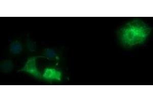 Image no. 3 for anti-Synaptophysin (SYP) antibody (ABIN1501259)