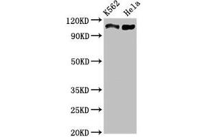 Western Blot Positive WB detected in: K562 whole cell lysate, Hela whole cell lysate All lanes: C16orf62 antibody at 3 μg/mL Secondary Goat polyclonal to rabbit IgG at 1/50000 dilution Predicted band size: 110, 94 kDa Observed band size: 110 kDa (C16orf62 anticorps  (AA 6-205))