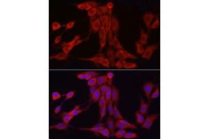 Immunofluorescence analysis of PC-12 cells using INPP5K Rabbit pAb (ABIN6132112, ABIN6142473, ABIN6142474 and ABIN6223771) at dilution of 1:150 (40x lens).