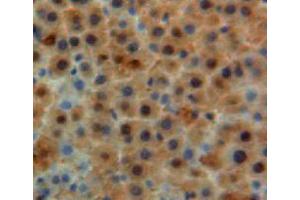 Used in DAB staining on fromalin fixed paraffin-embedded liver tissue
