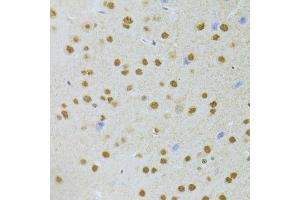 Immunohistochemistry of paraffin-embedded mouse brain using ANP32A Antibody.