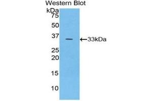 Detection of Recombinant PYGB, Human using Polyclonal Antibody to Glycogen Phosphorylase, Brain (PYGB)