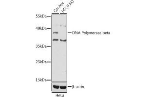 Western blot analysis of extracts from normal (control) and DNA Polymerase beta knockout (KO) HeLa cells, using DNA Polymerase beta antibody (ABIN3022384, ABIN3022385, ABIN3022386, ABIN1513390 and ABIN1514536) at 1:1000 dilution. (POLB anticorps  (AA 1-335))