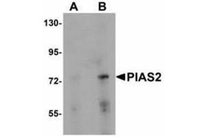 Image no. 1 for anti-Protein Inhibitor of Activated STAT, 2 (PIAS2) (N-Term) antibody (ABIN478291) (PIAS2 anticorps  (N-Term))