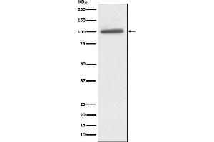 Western blot analysis of alpha Actinin 4 expression in A431 cell lysate.