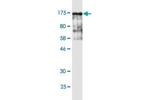 Western Blot detection against Immunogen (143 KDa) . (Vinculin anticorps  (AA 1-1066))