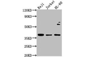 Western Blot Positive WB detected in: Raji whole cell lysate, Jurkat whole cell lysate, HL-60 whole cell lysate All lanes: RASSF2 antibody at 1:2000 Secondary Goat polyclonal to rabbit IgG at 1/50000 dilution Predicted band size: 38, 18 kDa Observed band size: 38 kDa (RASSF2 anticorps  (AA 69-326))
