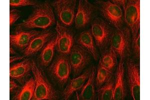 IF analysis of Syntenin 2/SDCBP2 and Tubulin beta using anti-Syntenin 2/SDCBP2 antibody (ABIN7600017) and anti-Tubulin beta antibody (ABIN7602744).