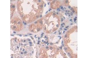 IHC-P analysis of Human Tissue, with DAB staining. (Peroxiredoxin 2 anticorps  (AA 6-164))