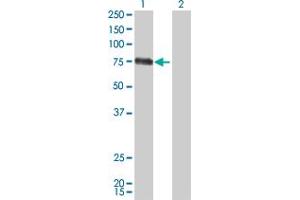 Western Blot analysis of CSF1 expression in transfected 293T cell line by CSF1 monoclonal antibody (M01), clone 1A9.