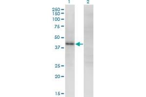Western Blot analysis of ZSCAN16 expression in transfected 293T cell line by ZNF435 monoclonal antibody (M01), clone 4A9. (ZSCAN16 anticorps  (AA 132-230))