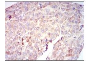 Immunohistochemistry (IHC) image for anti-V-Raf-1 Murine Leukemia Viral Oncogene Homolog 1 (RAF1) antibody (ABIN1108823) (RAF1 anticorps)