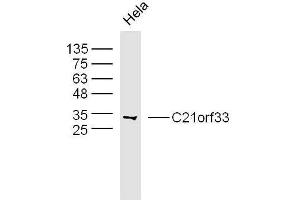 Human hela cells probed with C21orf33 Polyclonal Antibody, unconjugated  at 1:300 overnight at 4°C followed by a conjugated secondary antibody at 1:10000 for 90 minutes at 37°C. (C21orf33 anticorps  (AA 101-200))