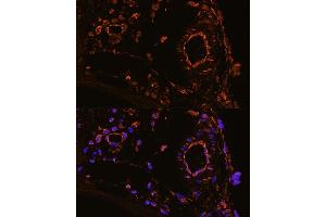 Immunofluorescence analysis of mouse colone artery using YB-1/YB-1/YBX1 antibody (ABIN6134494, ABIN6150328, ABIN6150330 and ABIN7101815) at dilution of 1:100.