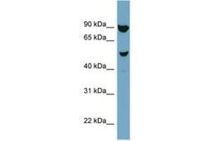 Image no. 1 for anti-Iroquois Homeobox Protein 2 (IRX2) (AA 107-156) antibody (ABIN6741969) (IRX2 anticorps  (AA 107-156))