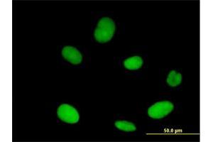 Immunofluorescence of purified MaxPab antibody to XPO5 on HeLa cell.