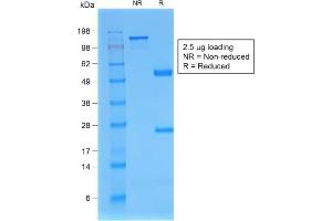 SDS-PAGE Analysis Beta-2-Microglobulin Mouse Recombinant Monoclonal Antibody (rB2M/961).