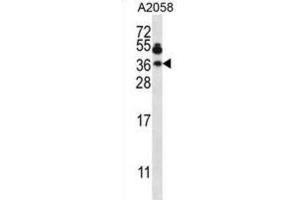 Western Blotting (WB) image for anti-Vesicle-Associated Membrane Protein 7 (VAMP7) antibody (ABIN2997586) (VAMP7 anticorps)